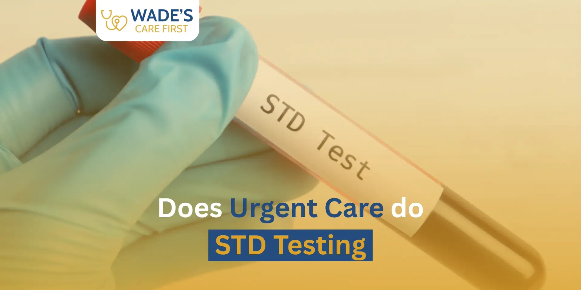 Does Urgent Care Do STD Testing?