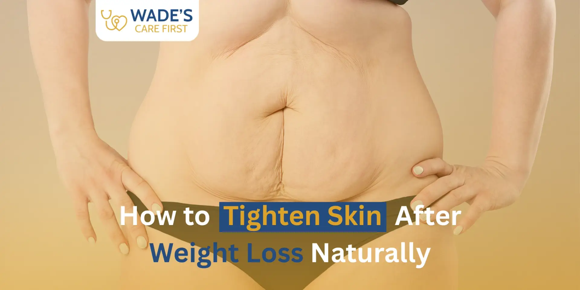 How to Tighten Skin After Weight Loss Naturally